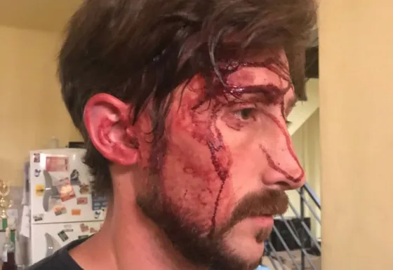 REPUDIABLE: Golpearon y amenazaron de muerte a concejal K y a su hijo