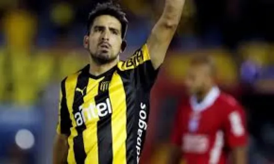 El rostro de Lucas Viatri luego de su accidente con pirotecnia