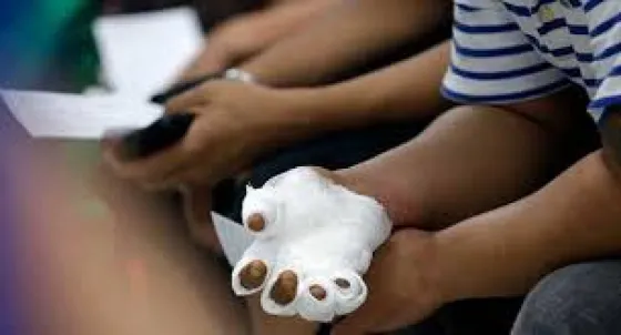 Disminuyeron los niños quemados por pirotecnia