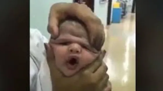 Enfermeras fueron despedidas por maltratar a un bebé recién nacido. Video