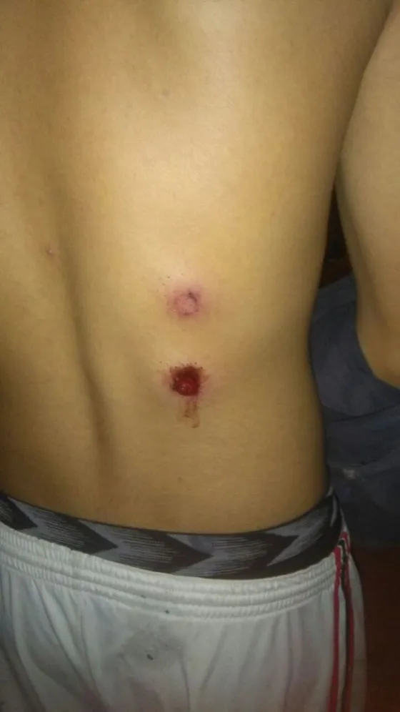 Represión en Solidaridad: "Lo mandé a mi hijo a comprar y terminó con 4 balas de goma"