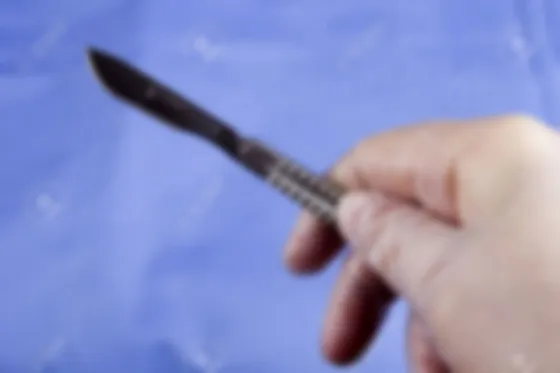 Durmió al novio con un juego sexual para castrarlo