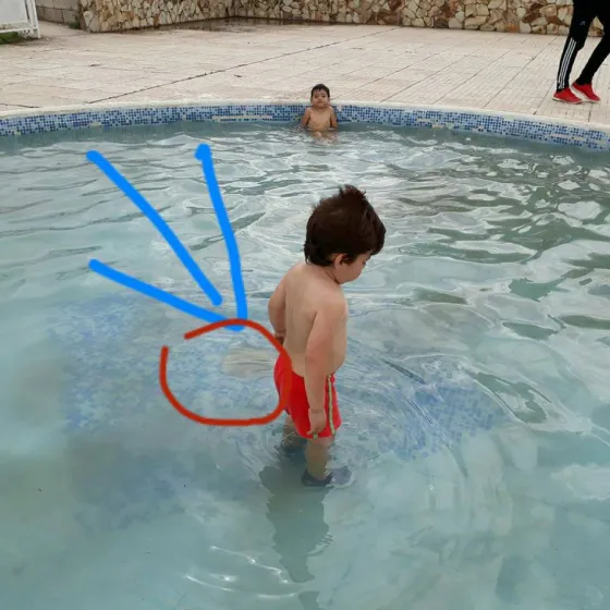 Un niño se accidentó en un camping de ADP y nadie se hizo cargo