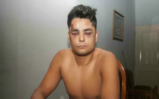 La Rioja: Policías dejaron inconsciente a un joven a golpes