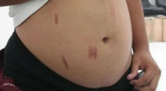 Lo detuvieron por golpear a su ex embarazada