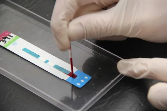 Villa Asunción: Realizan test rápidos de VIH