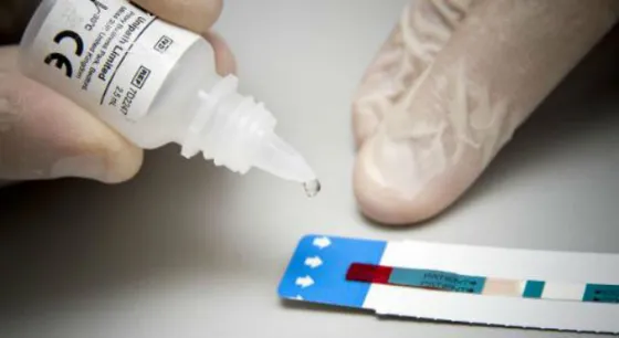 Atención: Realizan test gratuitos de VIH