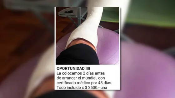 Se pasan: Ofrecen yesos para faltar al trabajo y ver el Mundial