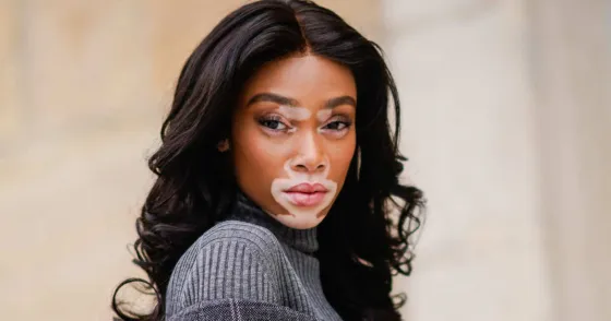 Terrible error de Winnie Harlow en la Formula 1. VIDEO