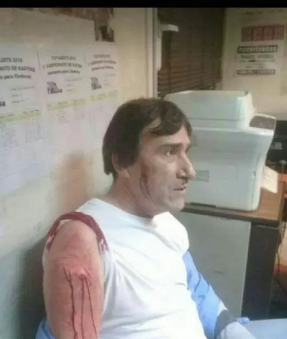 Conmoción: Violento ataque a un chofer de colectivos