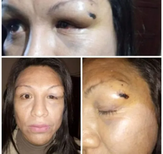 El calvario de una mujer trans: Policías la violaron y amenazaron de muerte