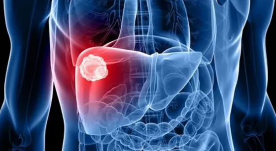 Día Mundial contra las Hepatitis: Entérate las actividades que impulsan desde Salud