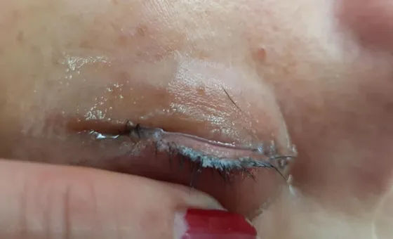 Tremendo: En un salón de belleza le dejaron pegados los parpados