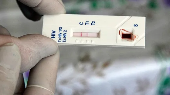 Atención: Realizan test de VIH en barrio Constitución