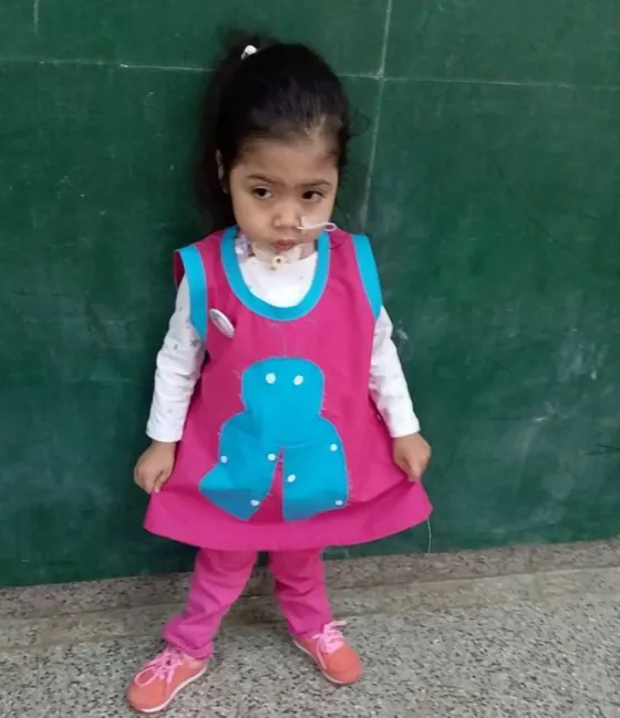 Campaña solidaria para ayudar a una niñita que padece Síndrome de Pierre Robin
