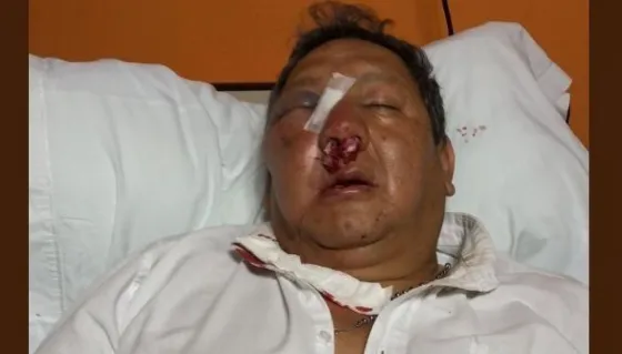 Sáenz sobre el inspector agredido: “Vamos a ir hasta las últimas consecuencias contra estos mafiosos”