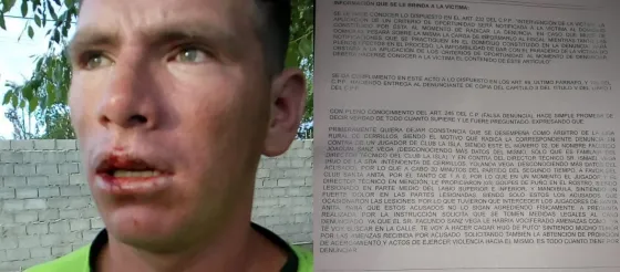 Árbitro agredido por los hijos de Yolanda Vega: “Recibí una oferta de 5 mil pesos para que levante la denuncia”