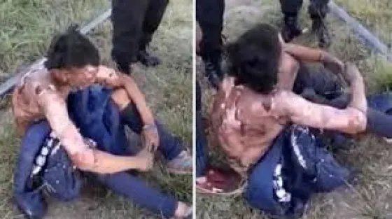 Murió el joven que se electrocutó en el Tren Roca