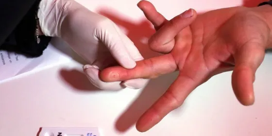 Habría un tercer paciente curado de HIV