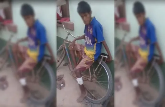 Gran tristeza: murió el joven wichí que estaba desnutrido