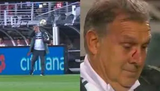 El Tata Martino recibió un tremendo pelotazo en el rostro. VIDEO