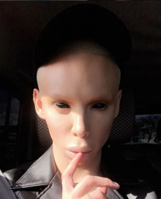 Se sometió a más de 100 cirugías para ser un "alíen asexuado"