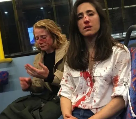 ¡Indignante! Se negaron a besarse en público y fueron brutalmente golpeadas