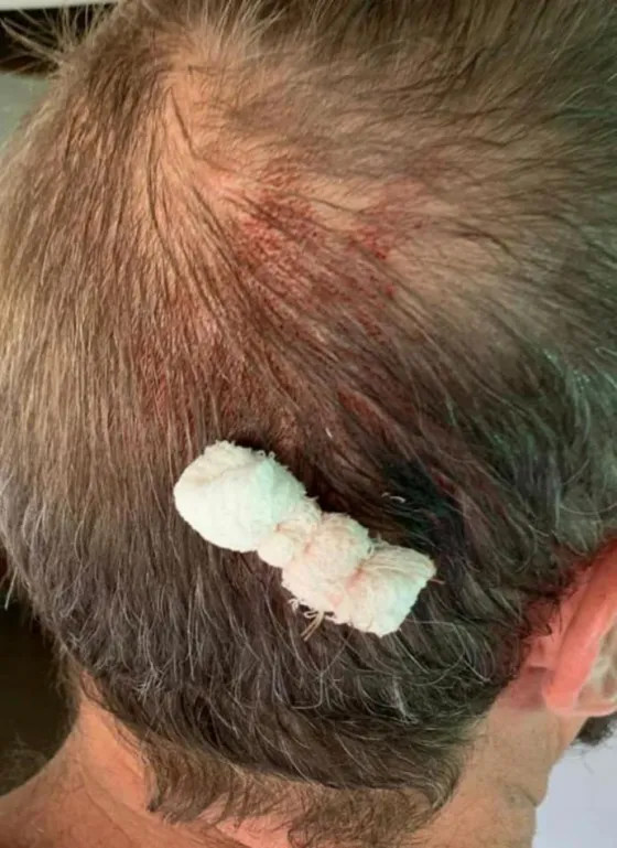 Sáenz responsabilizó a Leavy y Estrada por un ataque a su hermano