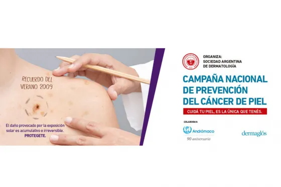 Atención : Inicia la campaña de prevención del cáncer de piel