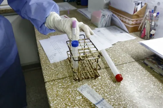En Salta se realizaron 247 test por coronavirus y se mantienen 2 casos en estudio