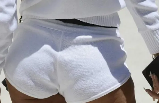 Descubren en una famosa las cicatrices de su última cirugía