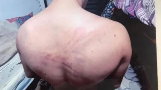 Le metieron una media sucia en la boca, lo golpearon y tuvo que sonreír a la cámara para evitar más agresiones