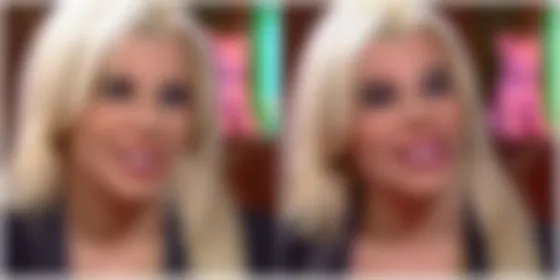 Joven famosa reapareció en TV tras nuevas cirugías