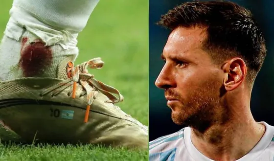 Cómo está el tobillo de Messi a horas de la final