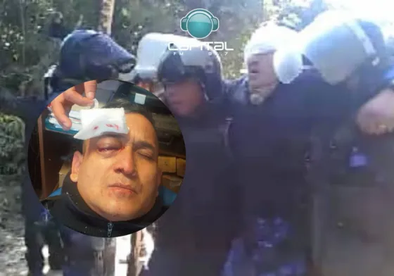 El policía herido en el enfrentamiento en Acambuco perdió la visión de su ojo