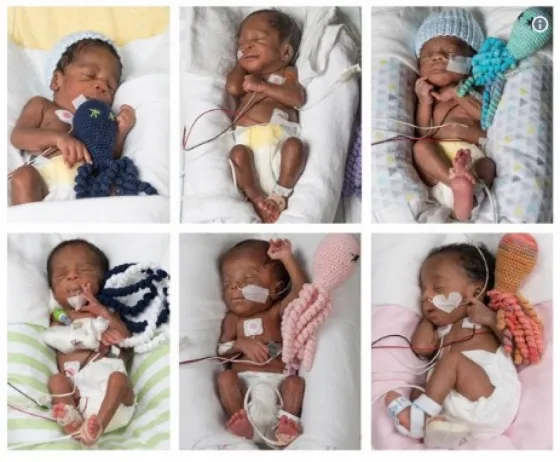 Tras 17 años intentando quedar embarazada dio a luz a sextillizos