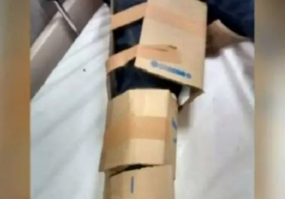 Orán: llevó a su hijo fracturado al hospital y lo "enyesaron" con cartón