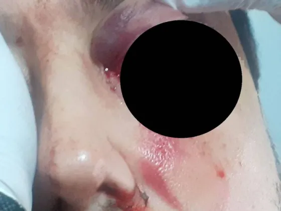 Chat de mamis de WhatsApp termina en una feroz pelea de papis: uno perdió un ojo