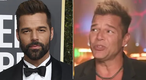 Catarata de memes por el ¿retoque estético? de Ricky Martin