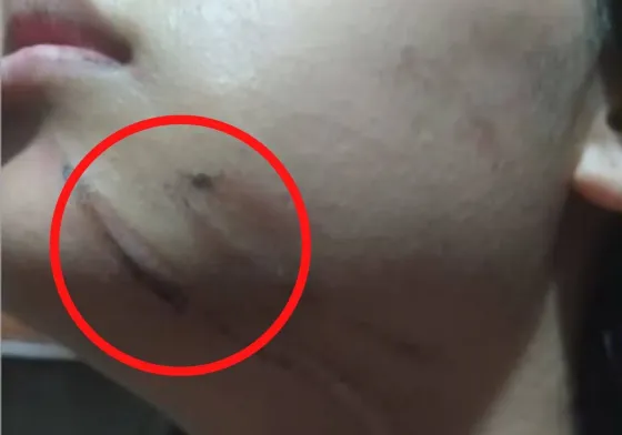 Una joven se enredó con unos cables que colgaban en plena vía pública