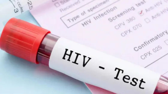 Hoy se hará test rápido para detectar VIH en el hospital Señor del Milagro