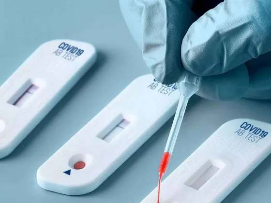 ¿No será poco? Llegaron sólo 30 autotest para COVID a Salta