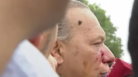 Berni denunciará a los colectiveros que lo agredieron