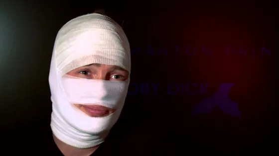 Quiso dejar a su mujer, ella no lo aceptó le tiró agua hirviendo y lo desfiguró