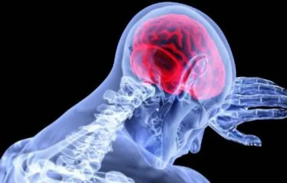 Aprobaron la creación de la Red Provincial de ACV para Garantizar el acceso a la salud