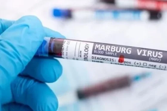 Murieron ocho personas por posible brote de la enfermedad del virus de Marburgo en Tanzania