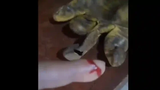 Jeringas y vidrios: trabajadores expuestos a residuos mal descartados