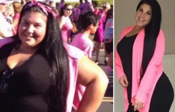 La increíble transformación de una joven que bajó 50 kilos. Foto
