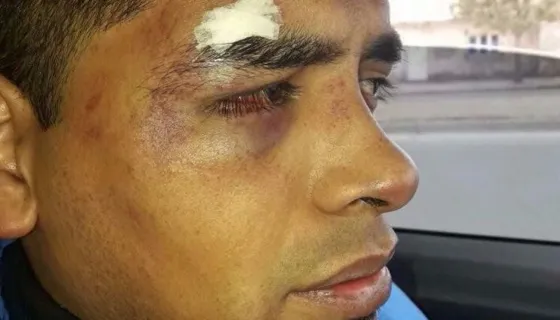 Chofer del 7D agredido (El Tribuno)