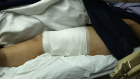 La atropellaron y la dejaron abandonada